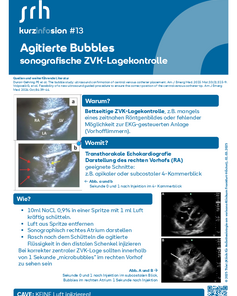 Agitierte Blasen zur sonografischen ZVK-Lagekontrolle, einschließlich Anweisungen zur Durchführung und Anwendung der Echokardiografie.